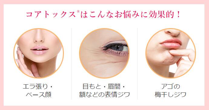 コアトックスRはこんなお悩みに効果的!「エラ張り・ベース顔」「目元・眉間・額などの表情ジワ」「アゴの梅干しジワ」