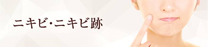 ニキビ・ニキビ跡